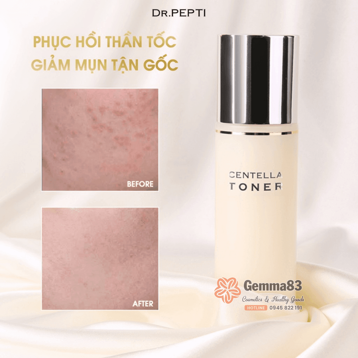 Nước hoa hồng Dr.Pepti Centella Toner 180ml dưỡng da căng bóng (8)