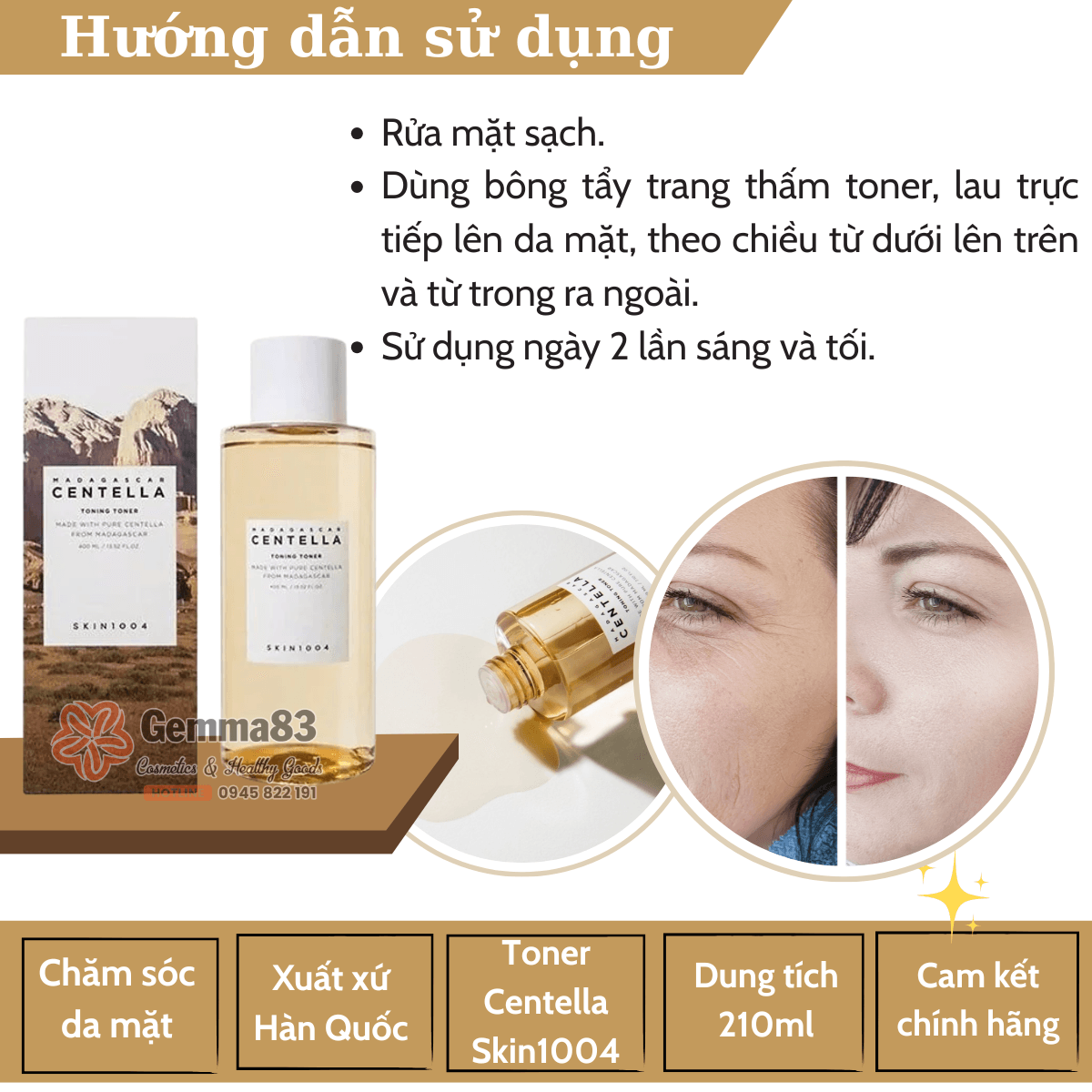 Nước hoa hồng Skin1004 Madagascar Centella Toning Toner 210ml phục hồi và tái tạo da (1)